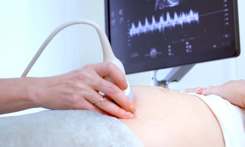 Close-up of an obstetrician using an ultrasound transducer on a patient's abdomen