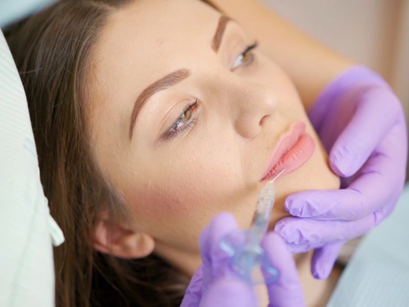 devojka na tretmanu derma filera