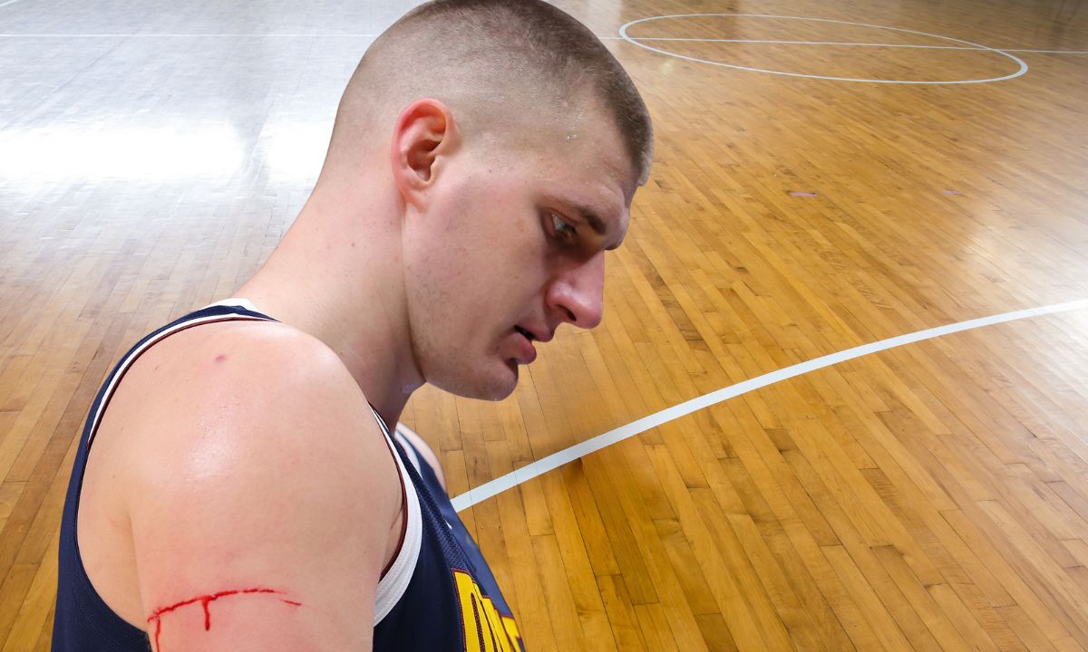 povreda nikole jokića